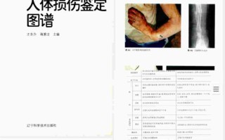 交通事故人体损伤图谱：现代法医学的“道路密码本”